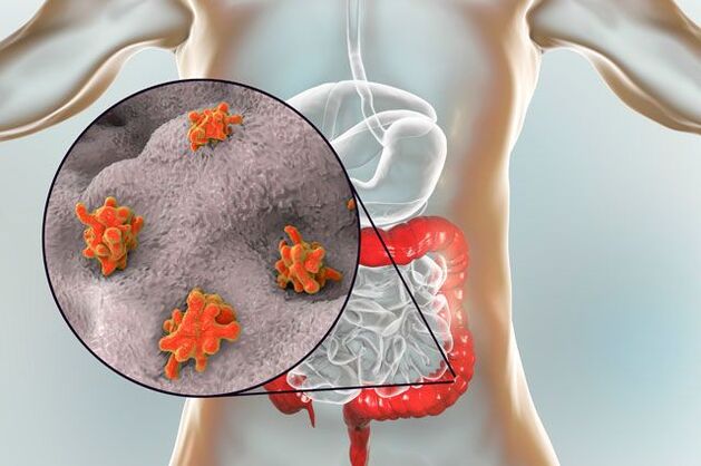 types of parasites in the human body