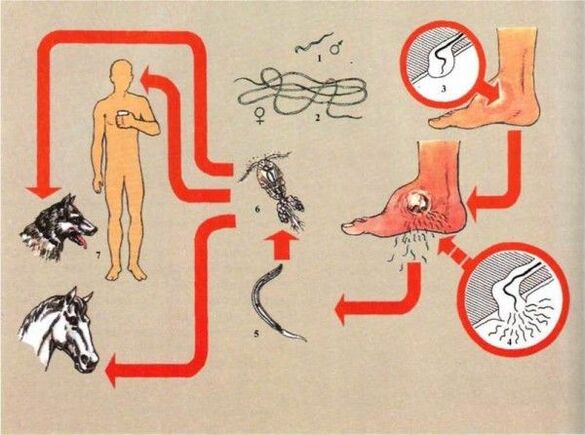 Development of dracunculiasis