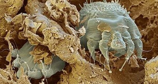 Scabies mite
