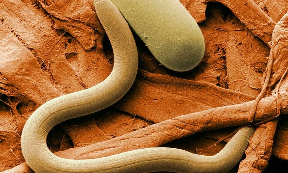 worms are parasites from the human body