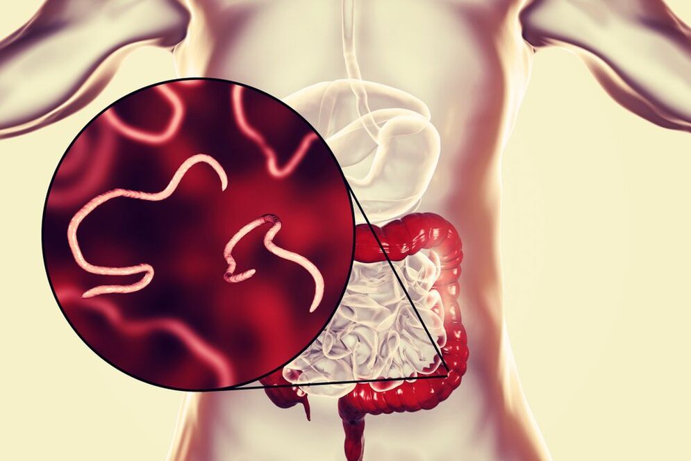 worms in the human intestines